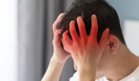 Thanh niên 21 tuổi đau đầu, ngủ li bì, đến bệnh viện mới biết u màng não, chuyên gia khuyến cáo cơ thể có 7 dấu hiệu này cần khám ngay!