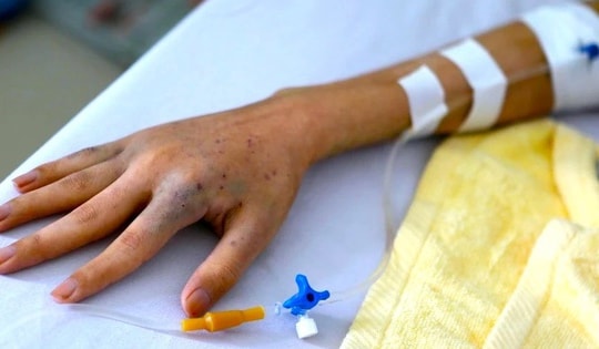 Nghĩ mình khỏe, cô gái 27 mắc ung thư giai đoạn 3 vì bỏ qua dấu hiệu này