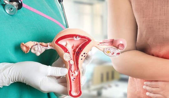 Người phụ nữ bị ung thư phải cắt bỏ cơ quan sinh dục vì xấu hổ không đi khám phụ khoa