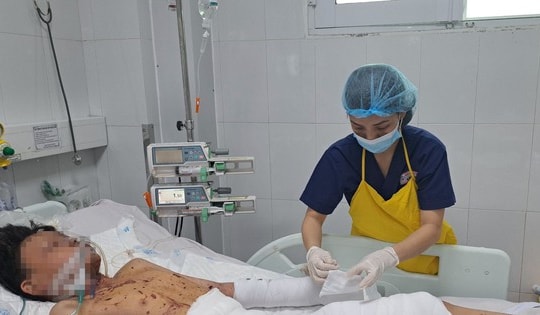 Chơi pháo nổ, bé trai bị dập vỡ nhiều bộ phận trên người