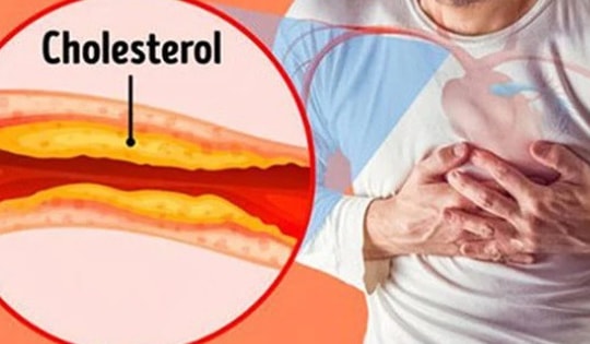 8 thực phẩm tự nhiên giúp giảm mỡ máu, người Việt nên ăn thường xuyên để phòng bệnh