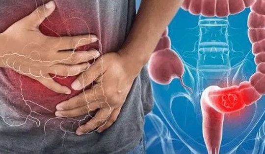 Hai vợ chồng phát hiện mắc chung 1 bệnh ung thư trong vòng 1 năm, thừa nhận có thói quen sai lầm mà nhiều gia đình người Việt đang mắc phải