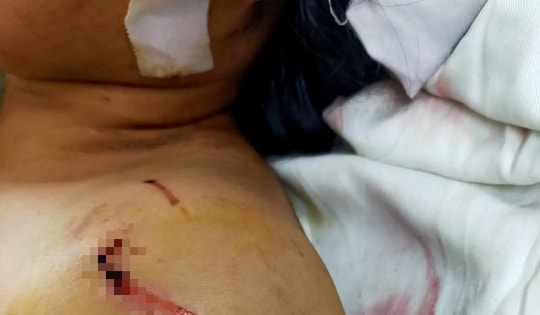 Đâm hai mẹ con người yêu nguy kịch rồi phóng hỏa đốt nhà