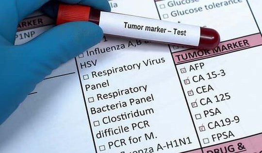 Xét nghiệm máu cho chỉ số ung thư tăng cao nên làm gì?