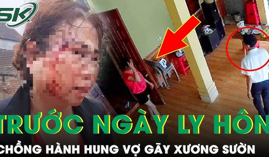 Chồng kém 11 tuổi bạo hành vợ trước ngày ly hôn: Đã lấy lời khai kẻ vũ phu