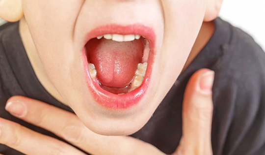 Điểm danh các bệnh lý nhiễm khuẩn tai mũi họng thường gặp và cách phòng ngừa