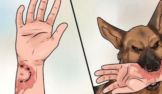 22 trường hợp tử vong vì bệnh dại, Bộ Y tế cảnh báo nguy cơ tiếp tục gia tăng