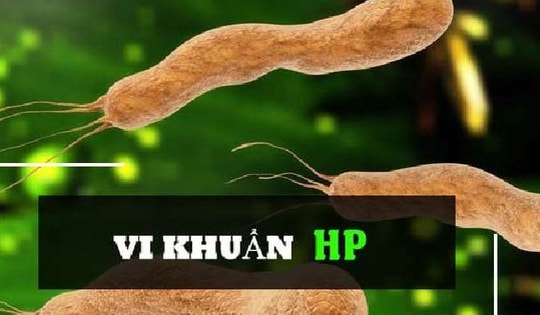 HP gây ung thư dạ dày, những điều cần biết về vi khuẩn này