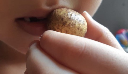 Bất cẩn khi ăn nhãn, bé gái 5 tuổi ở Phú Thọ suýt chết