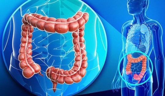 Người đàn ông 45 tuổi phát hiện mắc ung thư giai đoạn 3 vì trì hoãn làm việc này