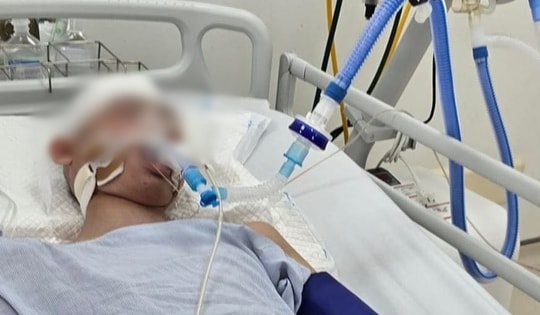 Thông tin mới vụ học sinh lớp 8 bị đánh chấn thương sọ não khi chơi bóng rổ