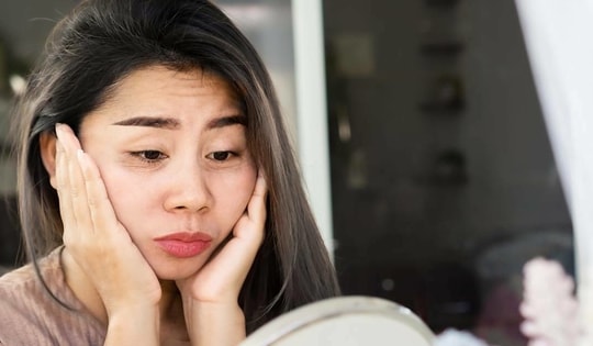 Ba loại quầng thâm và 4 'thuốc' đặc trị mắt gấu trúc