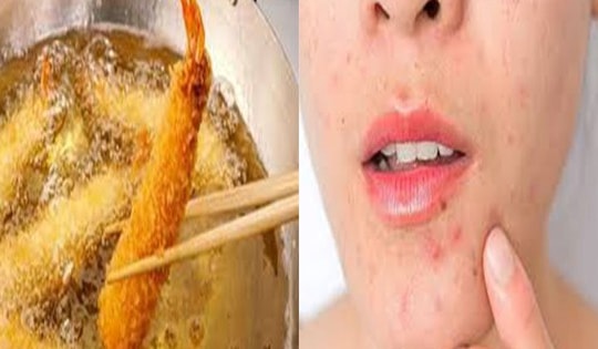 Chị em nên ăn rất ít 4 loại thức ăn yêu thích này nếu không muốn sụt giảm collagen, da xấu và nhanh già