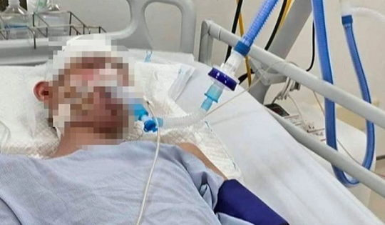 Thông tin mới về kết quả điều tra vụ nam sinh lớp 8 bị đánh chết não