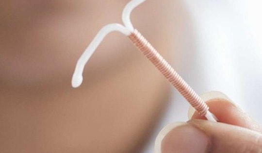 Đau bụng nhiều năm, phát hiện vòng tránh thai 'đi lạc' trong ổ bụng