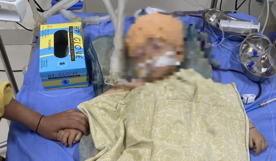 Điều tra nguyên nhân bé trai 1 tuổi chấn thương não ở trường mầm non