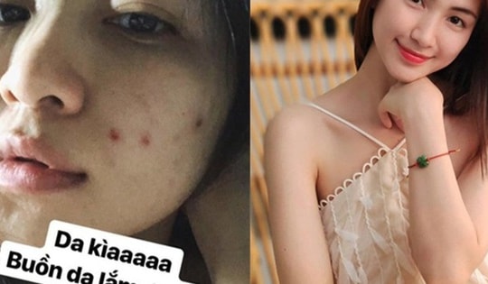 Hòa Minzy tiết lộ loại rau giúp làn da cô trắng mịn, mùa hè người Việt nên ăn để thải độc và kéo dài tuổi thọ