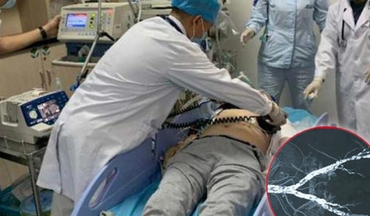 Người đàn ông có mạch máu vôi hóa như ruột bút chì, qua đời vì mê 1 thực phẩm