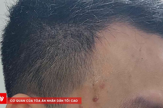 Chủ tịch UBND TP. Hà Nội yêu cầu làm rõ vụ 2 phóng viên bị hành hung