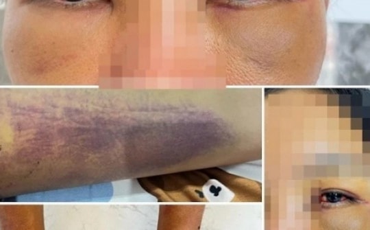 Hành hạ người khác vì cuồng tín, bị xử lý ra sao?