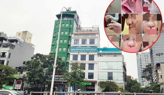 Thảm họa làm đẹp khi đến nhầm chỗ (Kỳ 1): Nâng mũi sụn lạnh Seogsun ở Viện Thẩm mỹ Quốc tế ChangWon, nhiều người bị phù nề, sưng mủ kéo dài