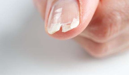 Các dấu hiệu cảnh báo cần bổ sung canxi