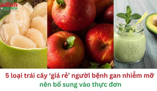 5 loại trái cây giá rẻ người bệnh gan nhiễm mỡ nên bổ sung vào thực đơn