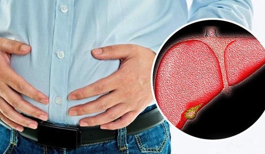 Giảm cân sai cách, cô gái 26 tuổi bất ngờ mắc bệnh gan nhiễm mỡ nặng