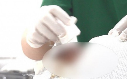 4 công nhân điện lực ở TPHCM bị bỏng nặng khi sửa điện