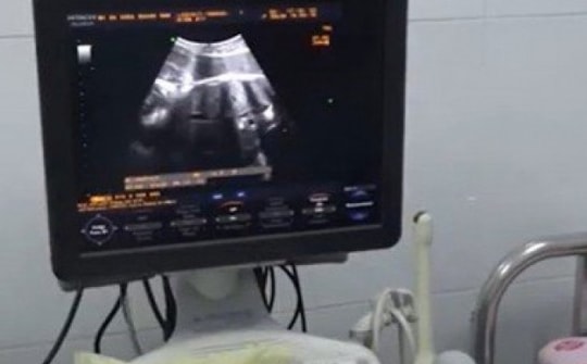 Sở Y tế Quảng Nam lên tiếng vụ bệnh nhân bị u buồng trứng phải, mổ bên trái