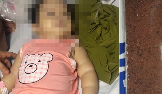 Quảng Bình: Bé gái 11 tháng tuổi ngộ độc chì do 'thuốc cam'