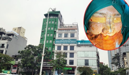 Thảm họa làm đẹp khi đến nhầm chỗ (bài 5): Nâng mũi ở Viện Thẩm mỹ Quốc tế ChangWon, một phụ nữ Hà Nội nhập viện cấp cứu, 'suýt' nhiễm trùng máu, phải chỉ định ngưng thai