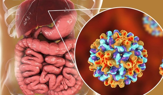 WHO cảnh báo về bệnh viêm gan siêu vi trên toàn cầu