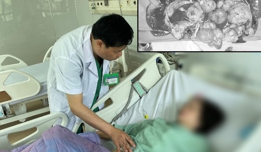 Nghĩ béo bụng, người phụ nữ bàng hoàng khi phát hiện khối u buồng trứng nặng gần 13kg