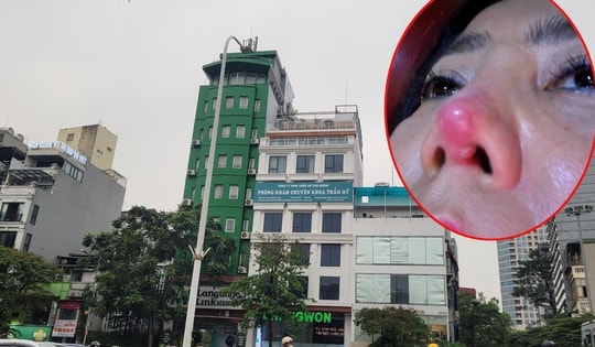 Thảm họa làm đẹp khi đến nhầm chỗ (bài 7): Hành trình 84 ngày của người phụ nữ 53 tuổi ở Hà Nội chống lại nỗi đau sau nâng mũi ở Viện Thẩm mỹ Quốc tế ChangWon