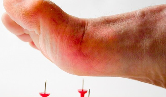 Người sau mắc bệnh uốn ván nên tập thể dục thế nào?