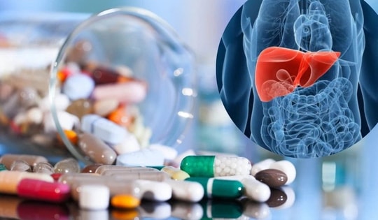 Làm gì để tránh tổn thương gan do thuốc gây ra?