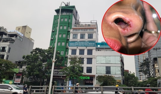 Thảm họa làm đẹp khi đến nhầm chỗ (bài 9): Nạn nhân thứ 8 của Viện Thẩm mỹ Quốc tế Changwon cấp cứu sau nâng mũi, vì sao Sở y tế Hà Nội vẫn chưa lên tiếng?