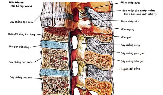 Các phương pháp trị thoát vị đĩa đệm