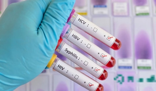 8 loại bệnh lây truyền qua đường tình dục thường gặp