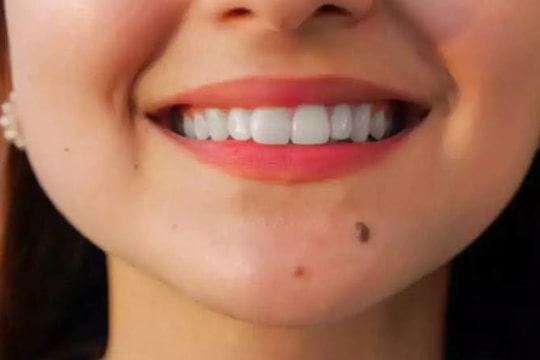 4 vị trí nốt ruồi ở phụ nữ dự báo giàu có và thịnh vượng