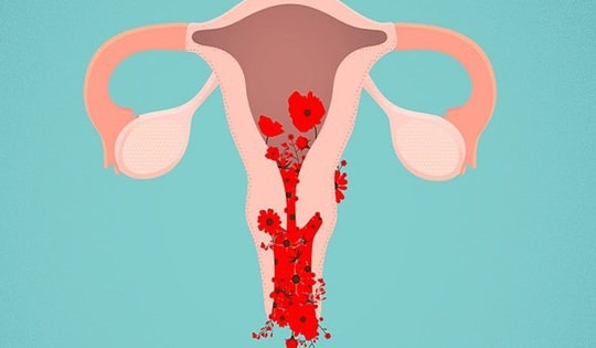 Khi nào chảy máu âm đạo là nguy hiểm?