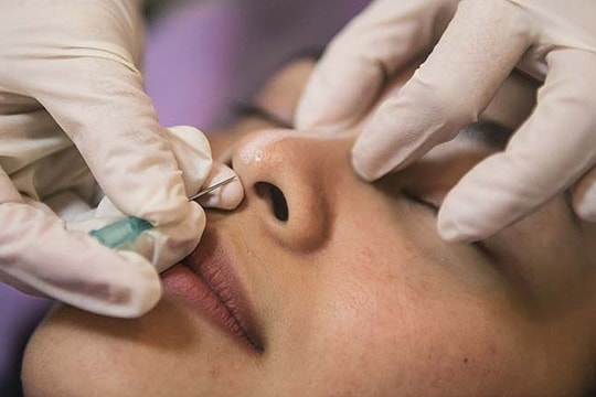 Người phụ nữ tử vong sau khi nâng mũi