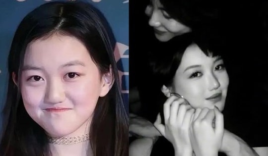Nhan sắc hiện tại của con gái Vương Phi - Lý Á Bằng sau 3 lần phẫu thuật hở hàm ếch