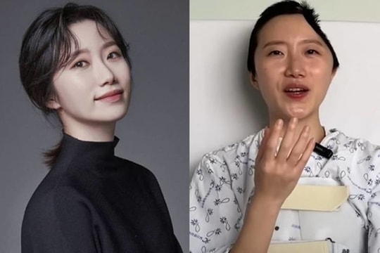 Nỗ lực của cựu tiếp viên hàng không sau khi cắt gần nửa hộp sọ