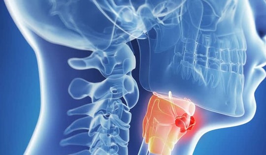 Khàn tiếng kéo dài 3 tháng, người đàn ông ở Hà Nội bất ngờ khi nghe bác sĩ thông báo