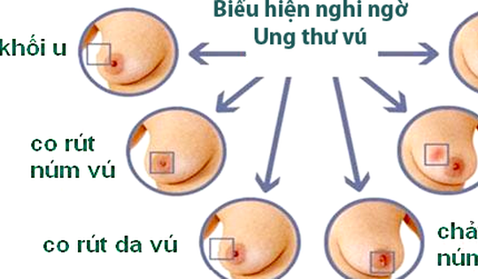 Tại sao tuổi cao trở thành yếu tố nguy cơ của ung thư?