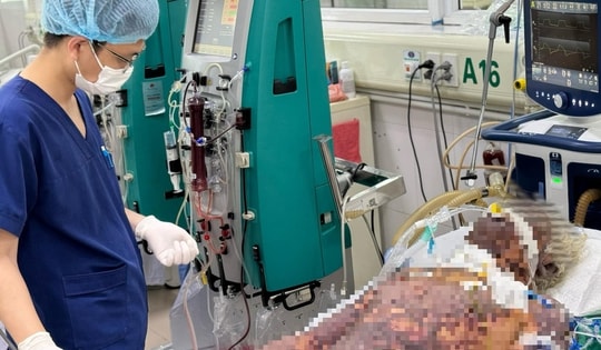 Người đàn ông 57 tuổi sốc nhiễm khuẩn, suy đa tạng vì loại vi khuẩn dễ gặp khi chế biến thực phẩm này