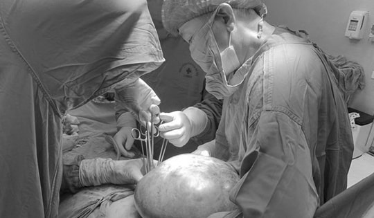 Nữ bệnh nhân 57 tuổi mang khối u buồng trứng nặng đến 7kg vì tâm lý chủ quan phụ nữ Việt hay mắc phải