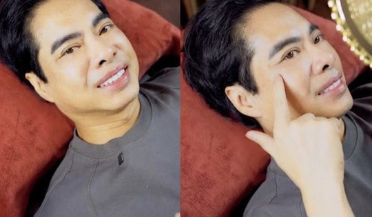 Diện mạo ca sĩ Ngọc Sơn ra sao sau khi 'tân trang' nhan sắc như đạo diễn Lê Hoàng?